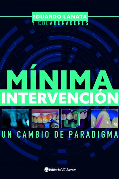 Mínima intervención